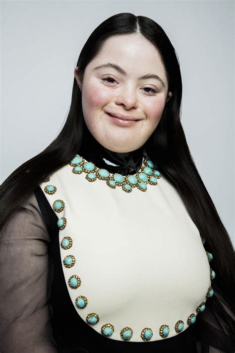 down syndrome model gucci.